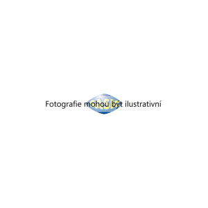 Tyc/vzpera, stabilisator (SASIC 1785385) 7110668